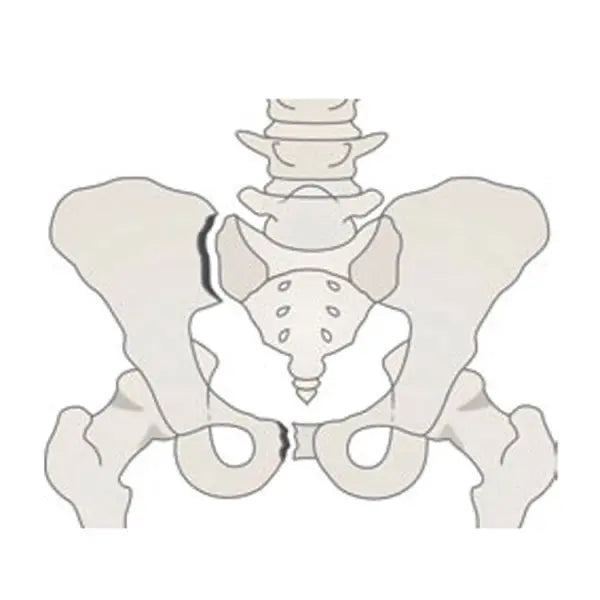 Pelvic sling